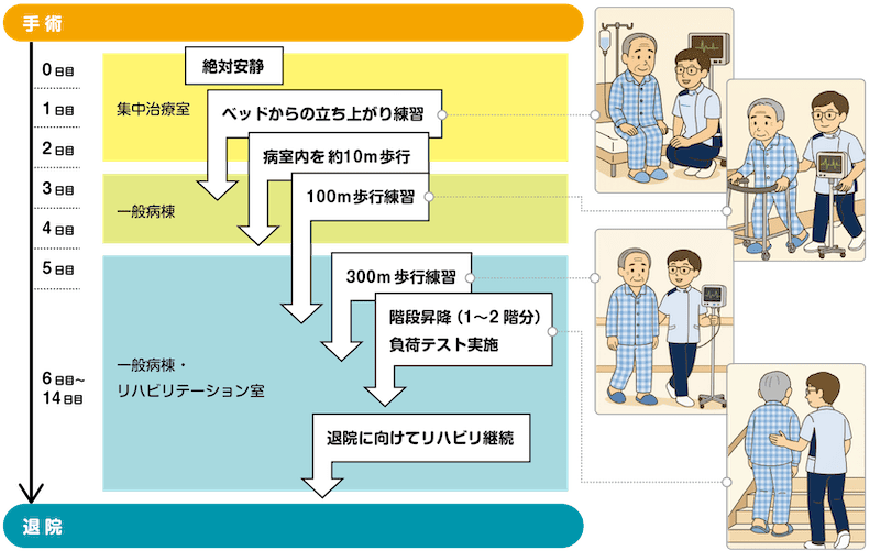 術後の離床プログラム