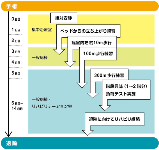 術後の離床プログラム