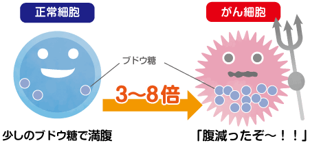 Pet検査とは 武蔵村山病院 画像診断 Petセンター